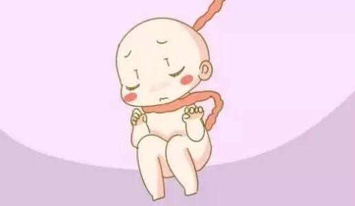 脐带绕颈胎儿全揭秘! 如何帮助胎儿“脱困”?