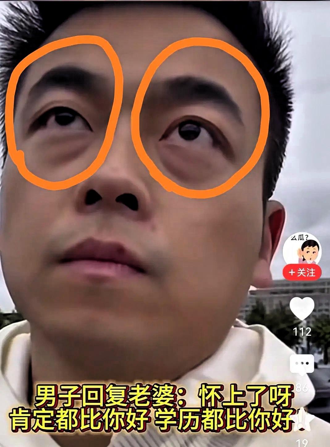 许晟骜这事儿哪是突然爆出来的？早有苗头了！你看他才30多岁，眼下那黑眼圈重得像