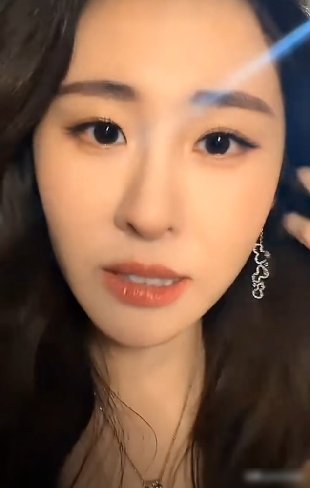 张碧晨直播说自己脸上突然长出一对酒窝。一边先出来的，一个多月后另一边也跟上了，对着镜头反复咧嘴笑给粉