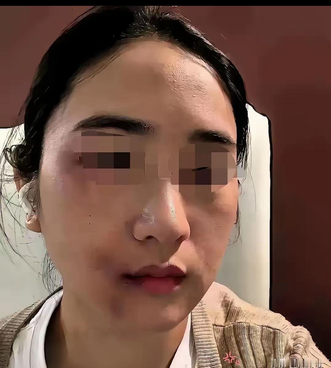 丈夫家暴妻子近十年，刚动手打完妻子三天，自己就确诊肝癌晚期，家人逼迫女方拿出全部