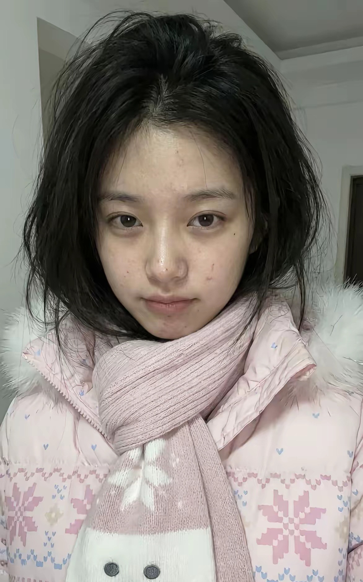 长相还可以，就是脸上老长痘痘，怎么解决呀？有没有知道的朋友？