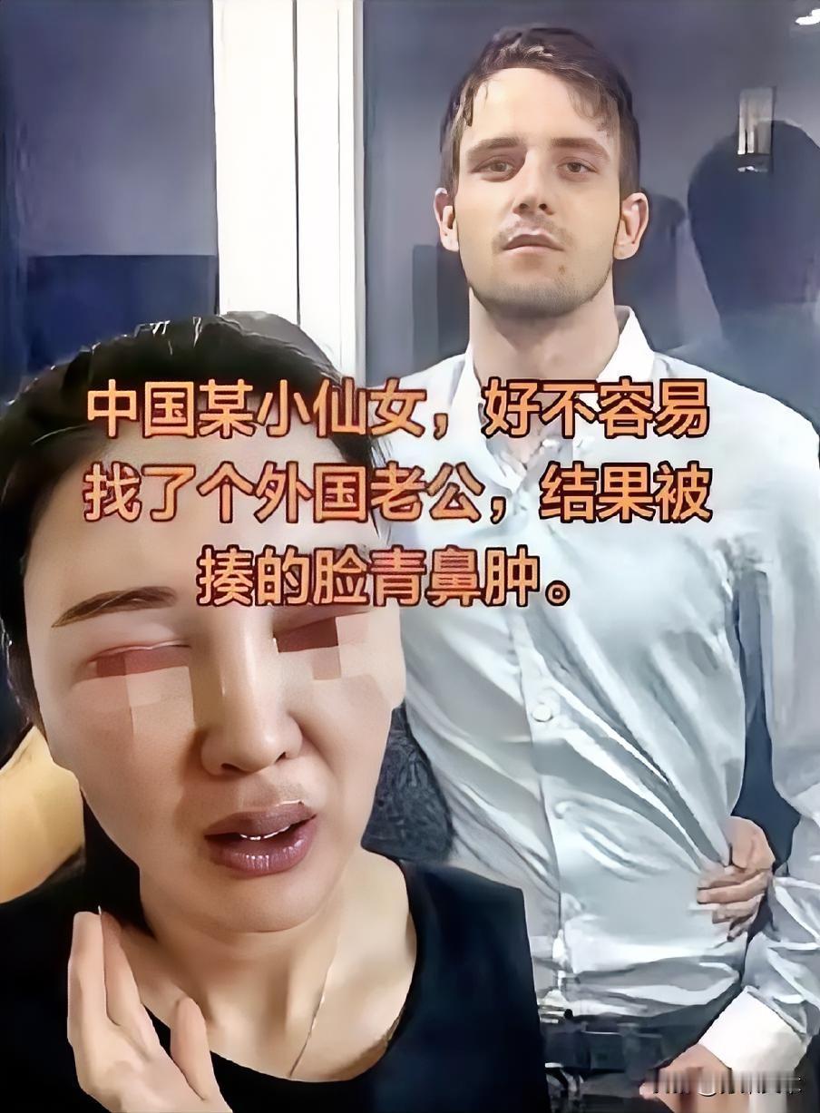 被打了。就是那个前阵子在朋友圈疯狂刷屏，逢人便炫耀自己“嫁给老外、嫁给了真正的