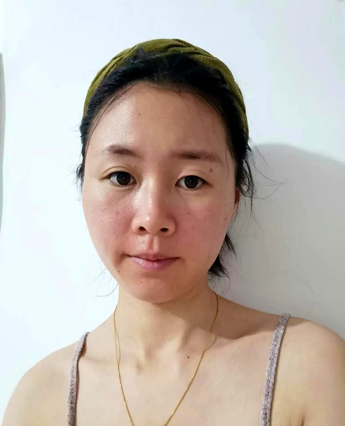 防晒面罩第一批受害者出现了。有网友女生分享自己带防晒面罩的经历，每天脸捂得严