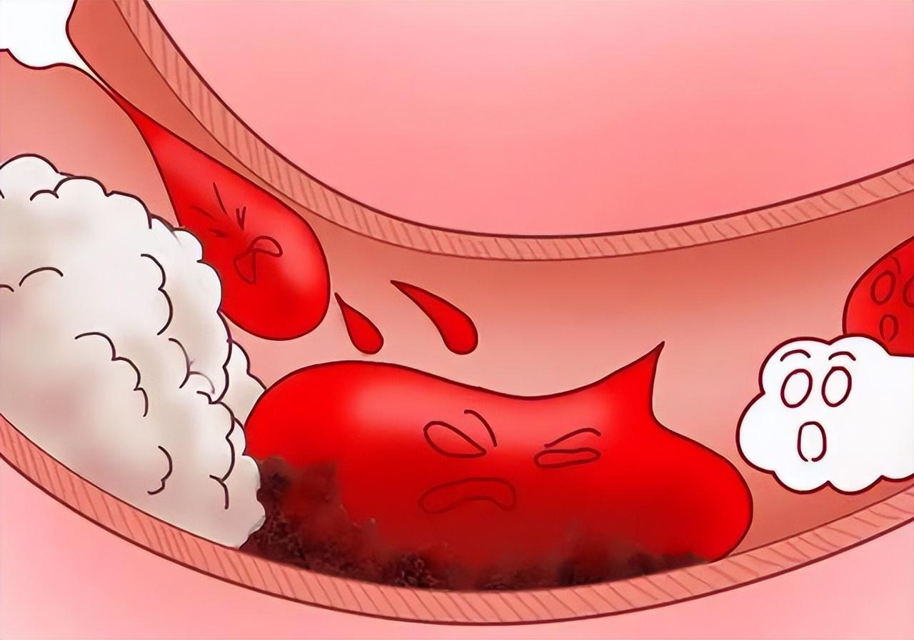 瘀阻久了，用桃仁红花没有用，就要用三棱、莪术破血行气，立见其功很多朋友被血瘀