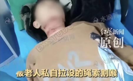 被割喉的男孩已经转到北京儿童医院icon了，目前还在ICU。听说肇事老人的儿子