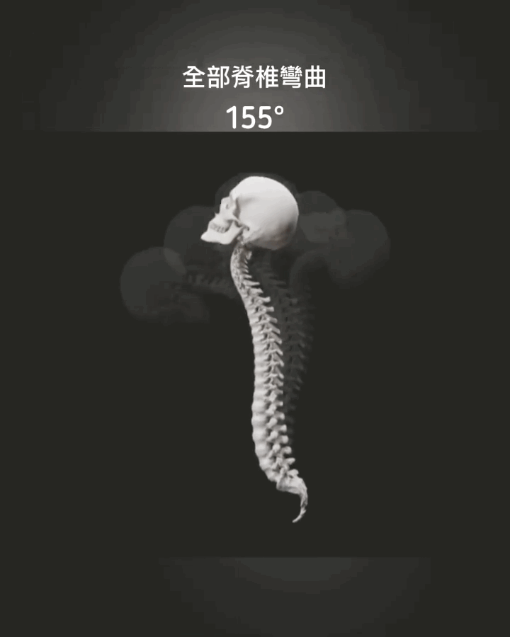 腰椎间盘突出﻿﻿为啥有人天天瘫着，也没腰疼，而有些人好好注意姿势，还是突了？