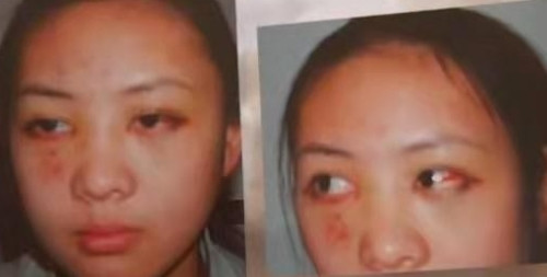 2003年，张国立的儿子张默在中戏门口殴打自己的女朋友童瑶，18岁的童瑶跪地恳求