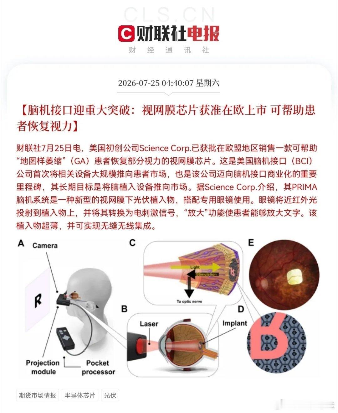 重大消息！重大消息！脑机接口迎来利好消息了，这下好了，满仓脑机接口的要乐开花了，