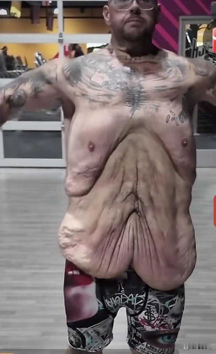 他曾经是一位体重达一仟五百斤的大胖子，因为受不了别人的嘲笑，开启了艰苦卓绝的减肥