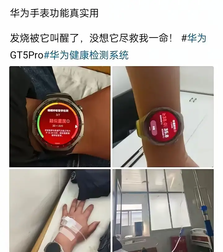建议其他品牌普遍推广这个功能