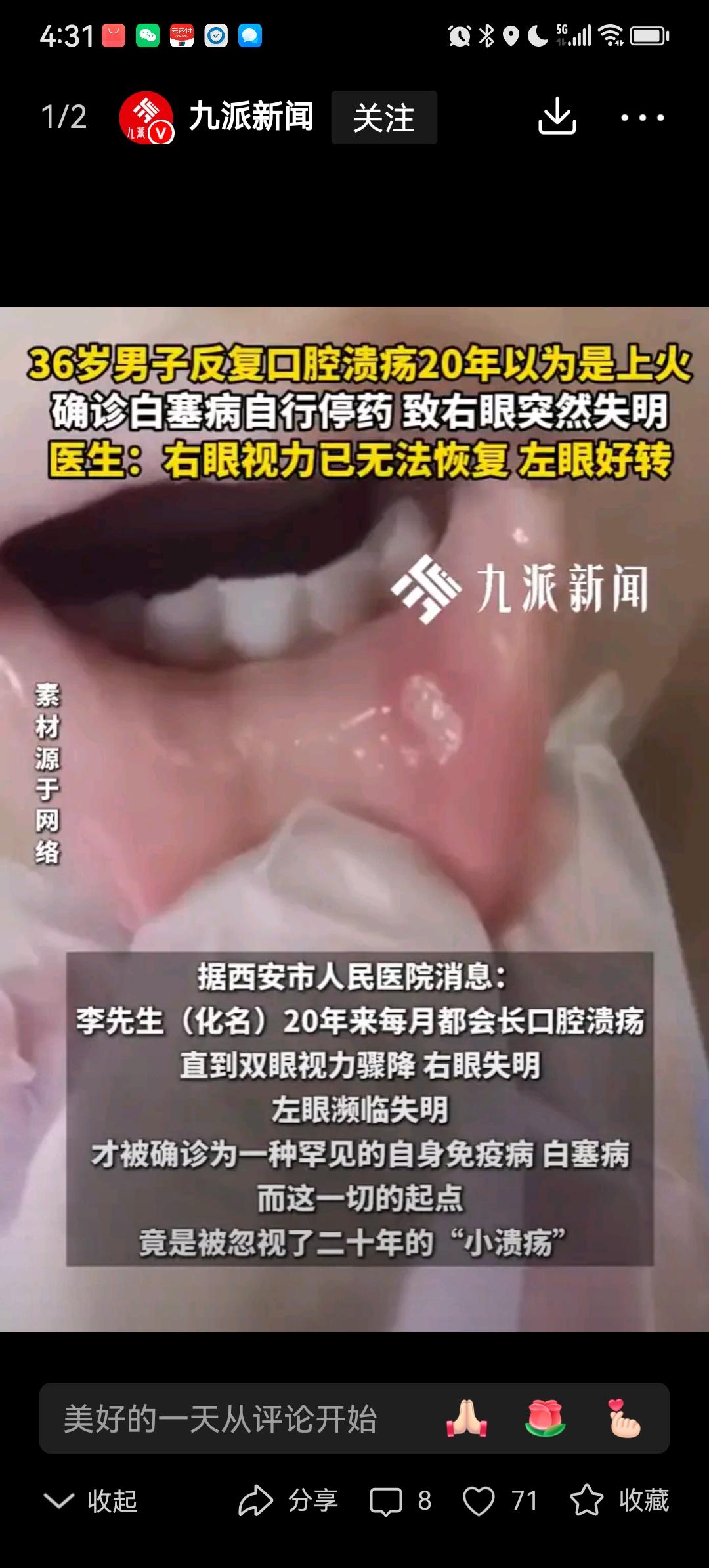 震惊！36岁男子20年口腔溃疡误以为“上火”，最终失明！专家提醒：别再忽视这些信