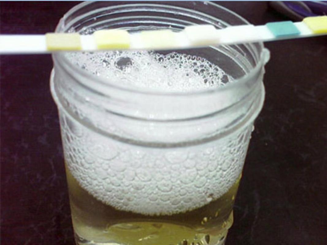 血糖高不高？看小便就知道，小便出现4种异常，警惕糖尿病不少人对血糖的关注只停