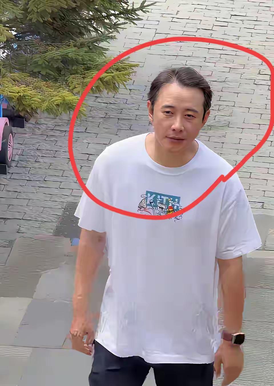 天呐，这也太夸张了，怎么变成这样了，以前多有型多帅呀，可能他老爸去世打击太大了，
