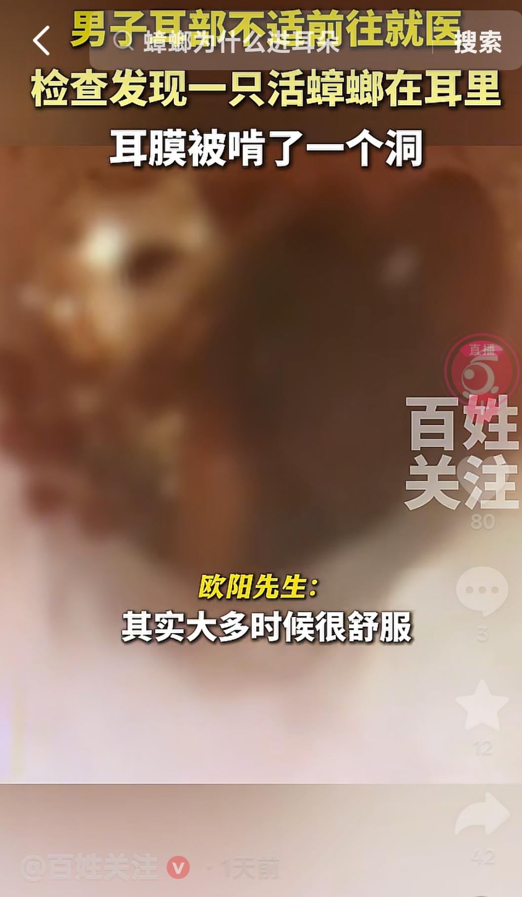 5月28日，广东深圳，一男子感觉耳朵不舒服，他去医院看医生，没想到医生发现一只活