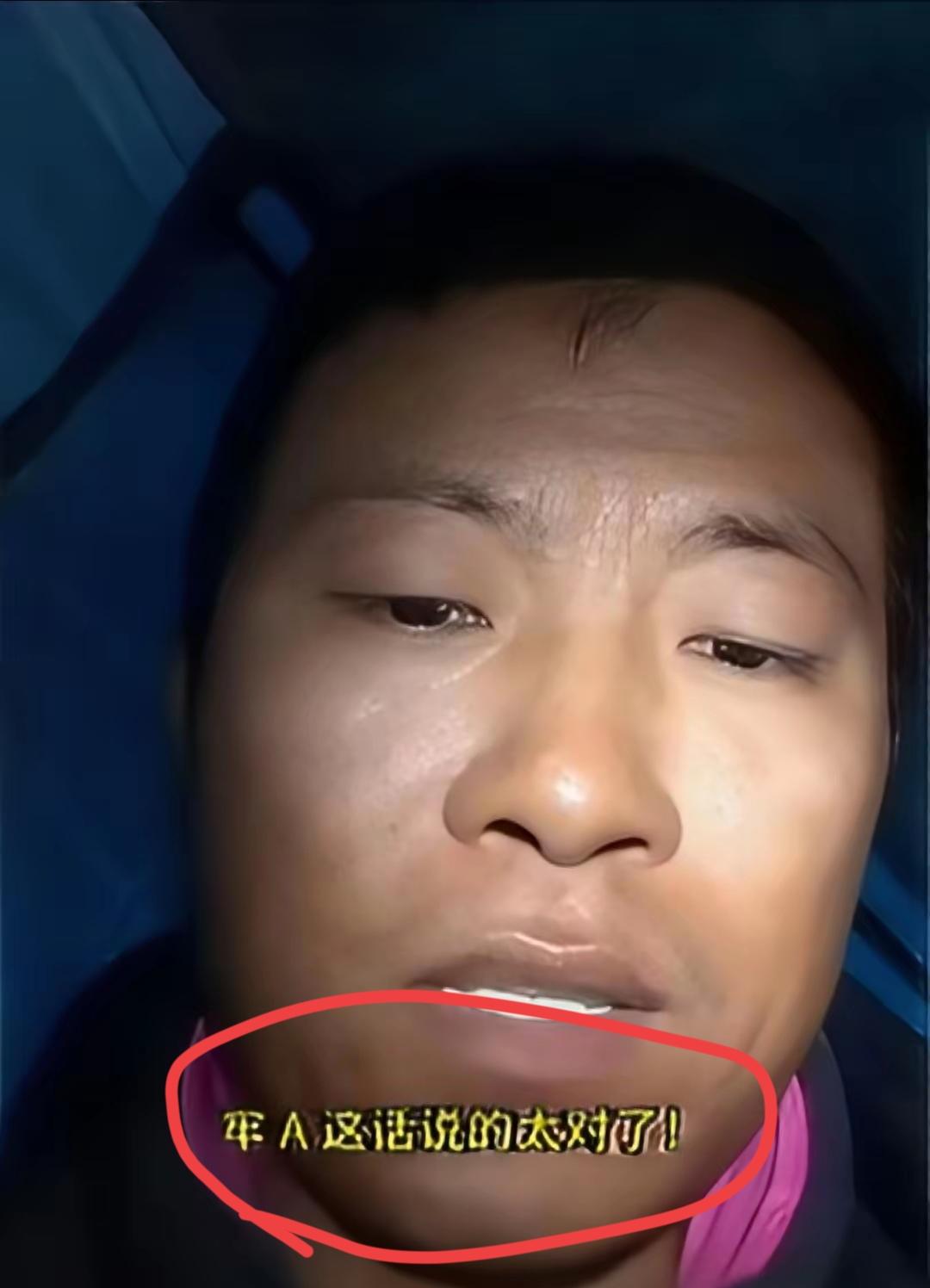 “甜甜圈”最近不知道受到了什么刺激，眼睛湿润的表示“牢A说的太对了”。这让一