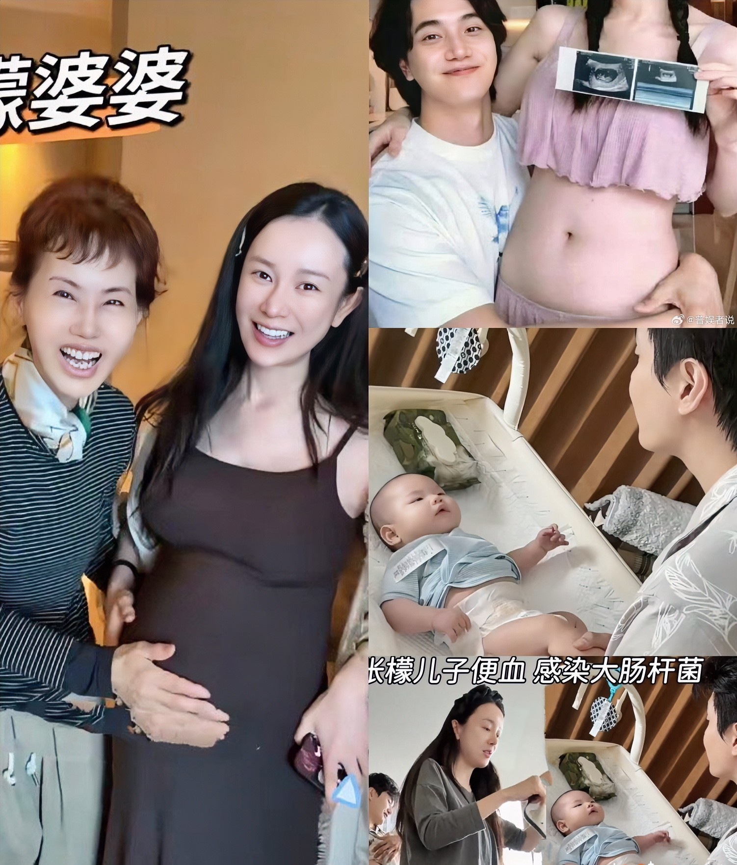 张檬有点不对劲啊其他明星都不晒娃她倒好，不仅晒出来，恨不得从备孕到生孩