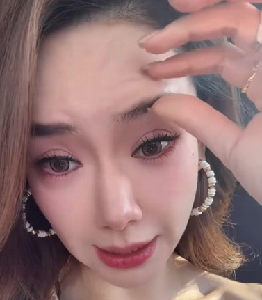 谁说医美圈里没有真诚的女星？戚薇就直接自曝：打肉毒把脸打僵了，连眉毛都动不了！