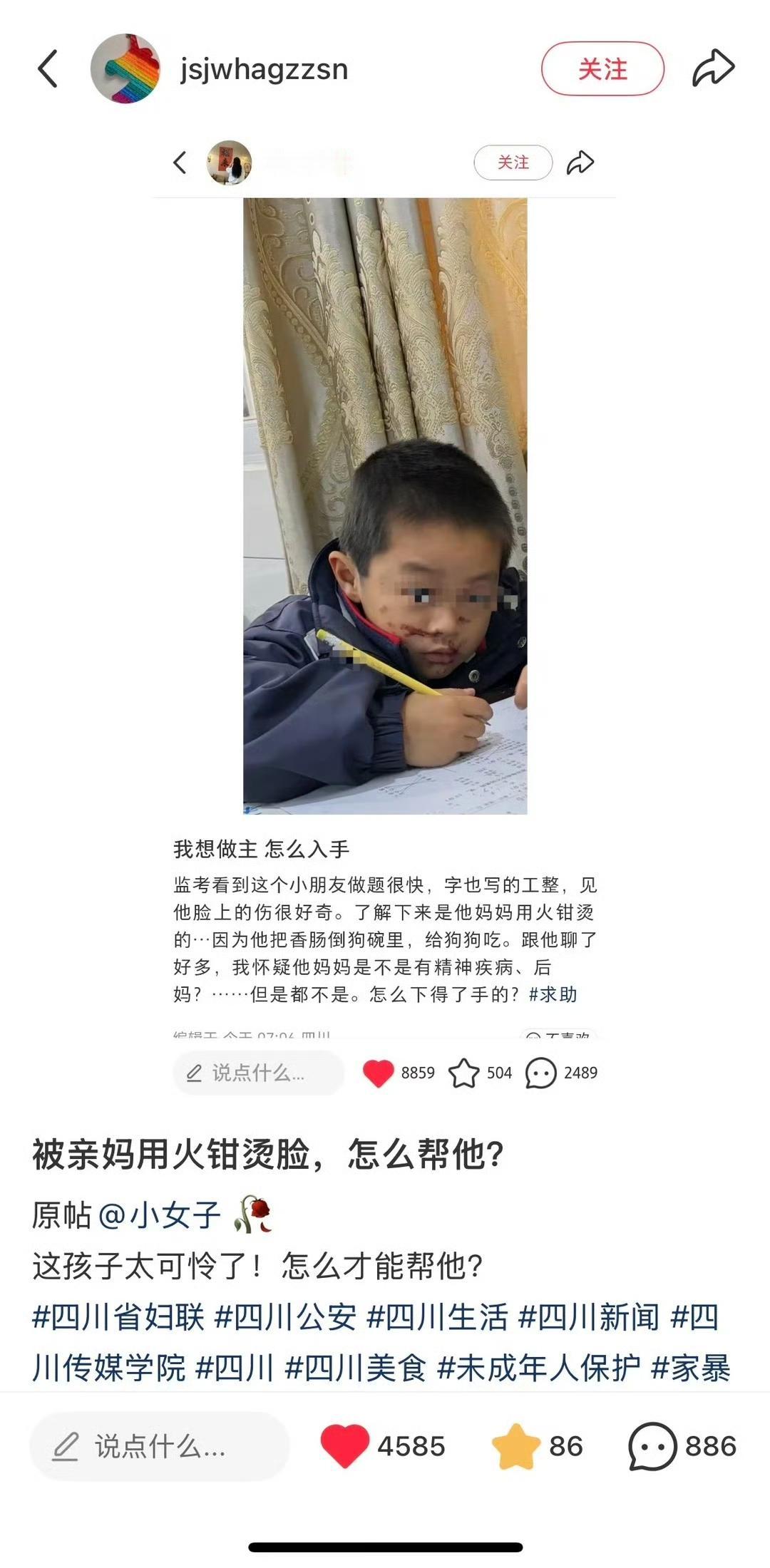 因为把香肠给狗吃，就用火钳烫脸？不知老师有没报警？真会有这么夸张的妈妈？​​​