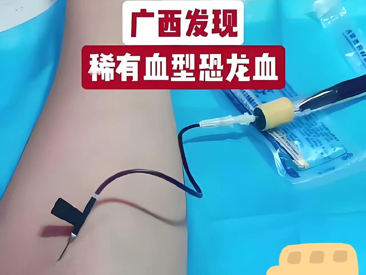 吓人！广西大哥查出“恐龙血”，全球仅2例，网友急着喊他隐姓埋名！这可不是普