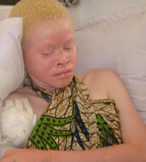 [点赞]在非洲买卖身体这事儿上，真是活见鬼了——你好好一个正常人，两个肾都健健