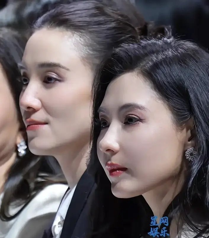 张柏芝这组图医美痕迹过重了。明明年轻时骨相那么抗老，现在脸部馒化得让人一眼认不出。​