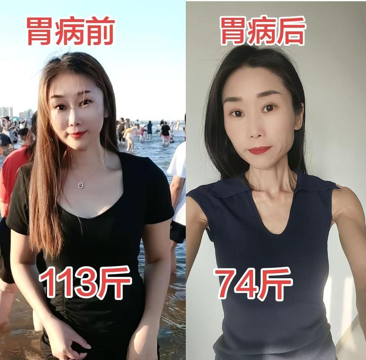 胃病带来的折磨和痛苦只有自己能体会，它夺走了我所有的美好，没有了当初的快乐和自信