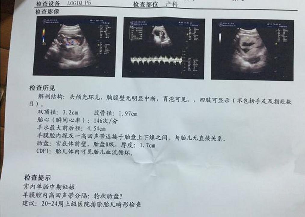 孕妇产检后家人同意剖腹产, 不料手术时婆婆反悔, 娘家人知道后震怒