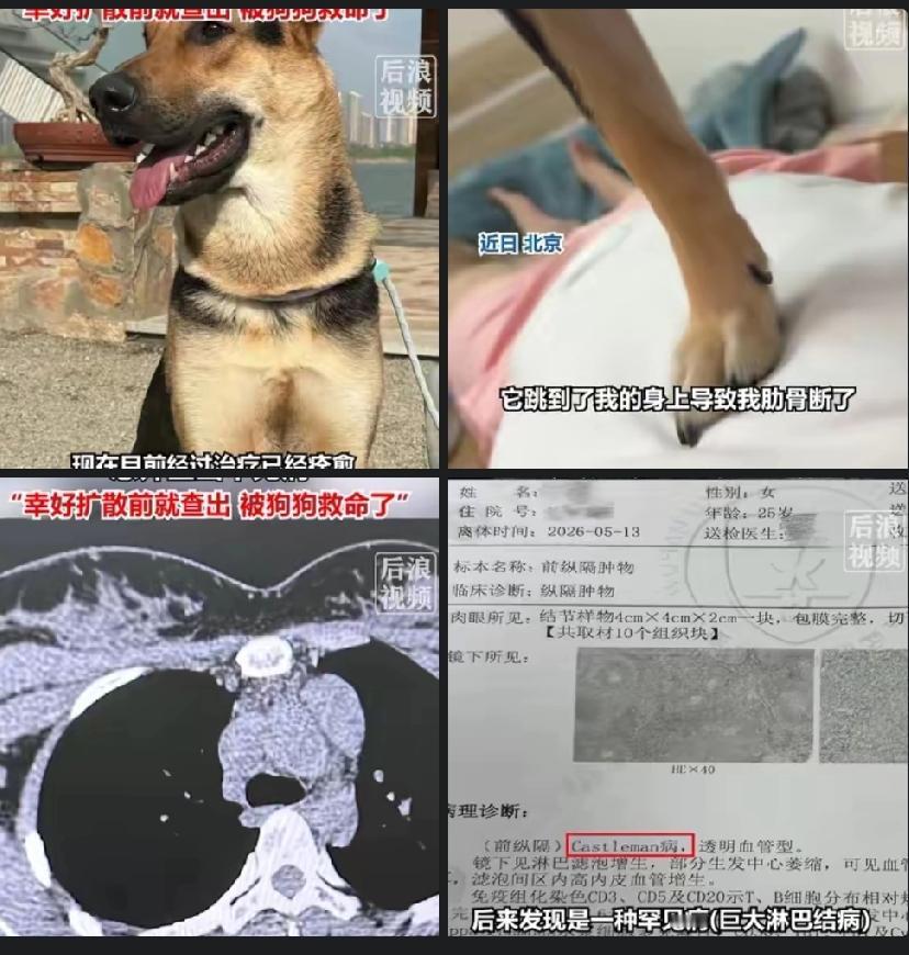 解释不清了！北京一只80斤的牧羊犬，突然跳主人身上，把她踩骨折了，谁料到医院一