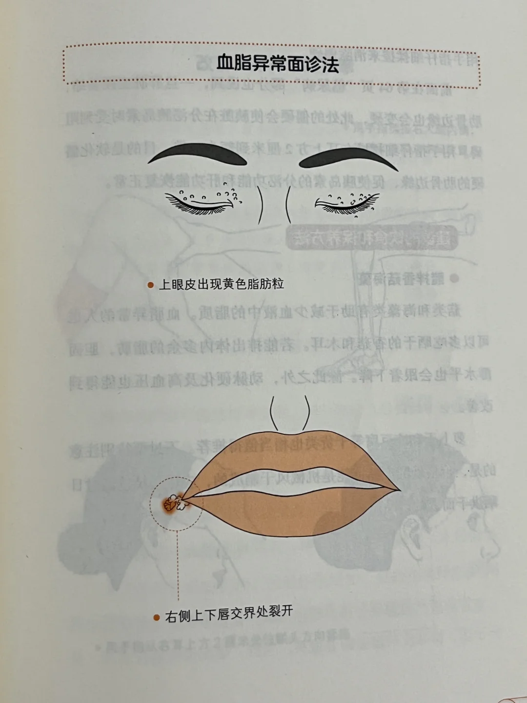 中医：血脂异常面诊法