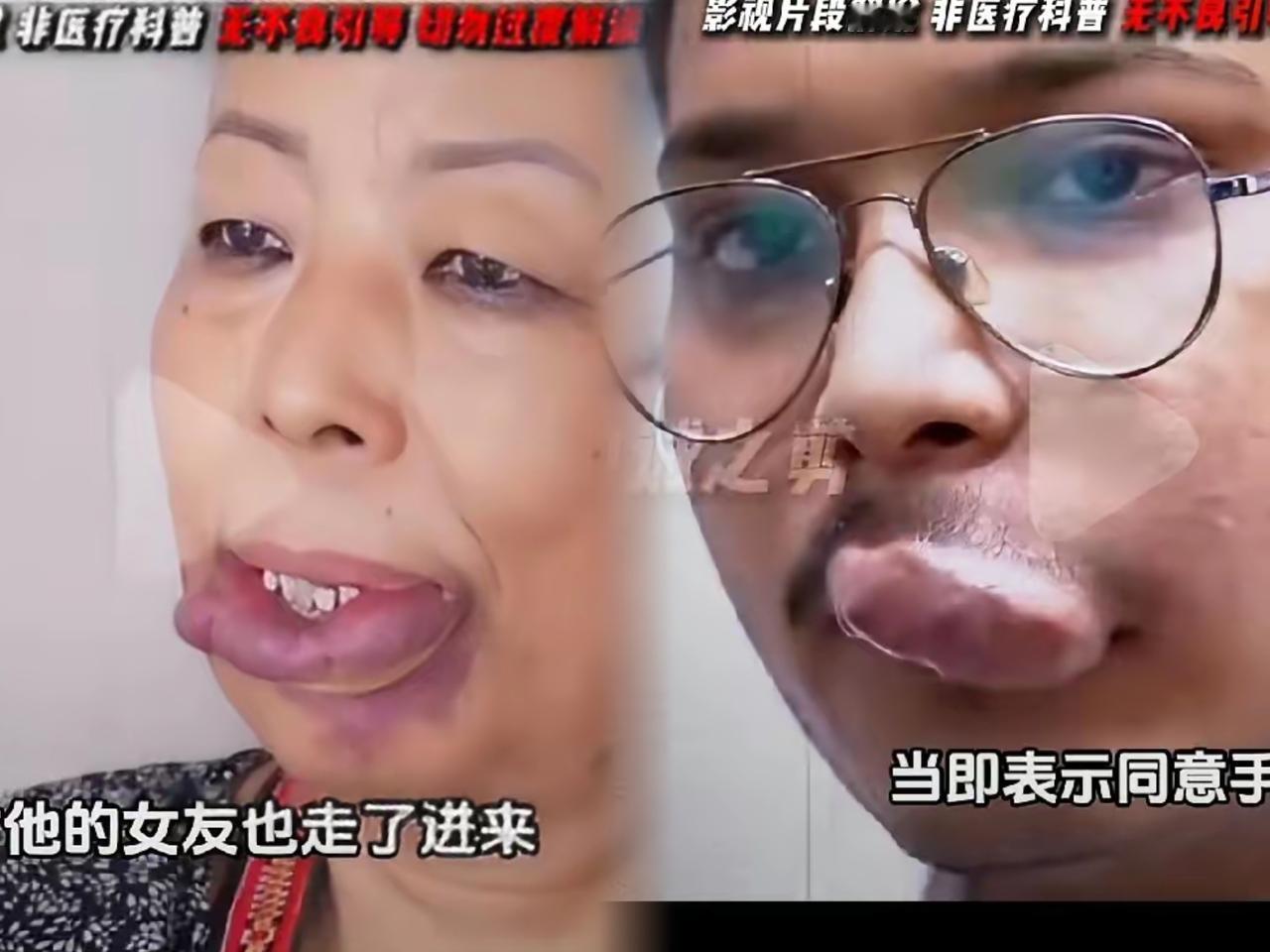 情侣一天亲800遍，结果把嘴巴亲出“致命风险”？这可不是夸张！本以为是恩