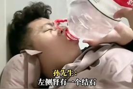 2025年。山东一小伙为了省12000手术费，每天喝五升水，结果尿出9毫米结石！