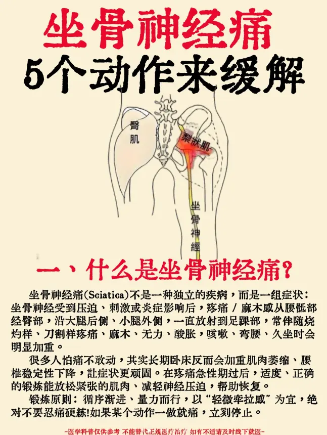坐骨神经痛？5个安全动作缓解