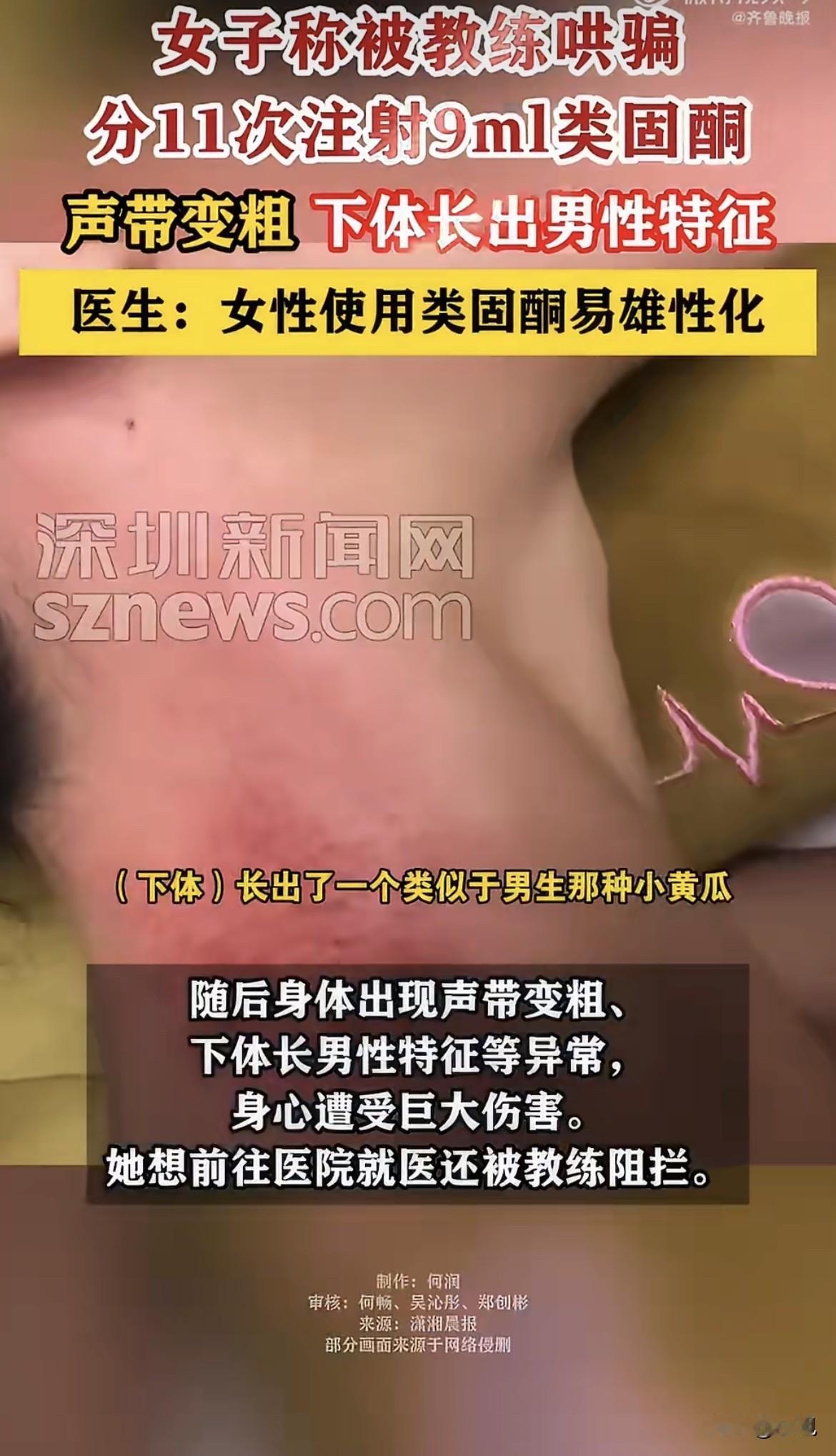 破防了。杭州一个女的，被健身教练哄着打了半年针，打完发现自己变成阴阳人了。她