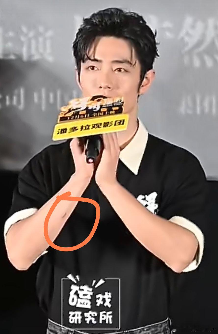 肖战手上的疤是不是好不了了🥹