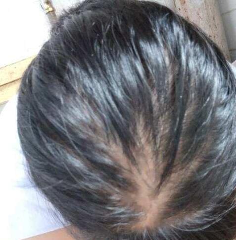 洗头发时用这种药草, 让你的头发不再油腻腻, 还能防止脱发