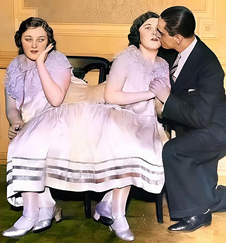 上世纪四十年代的美国一对连体姐妹。多么好的分离条件，两姐妹没有做手术。两人同生共