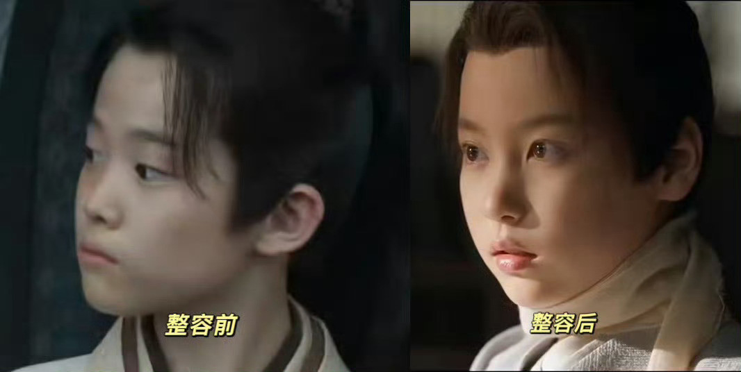 笑死……真的有点太严谨了！！藏海也割了双眼皮，微do了👀藏海微do藏海微do了