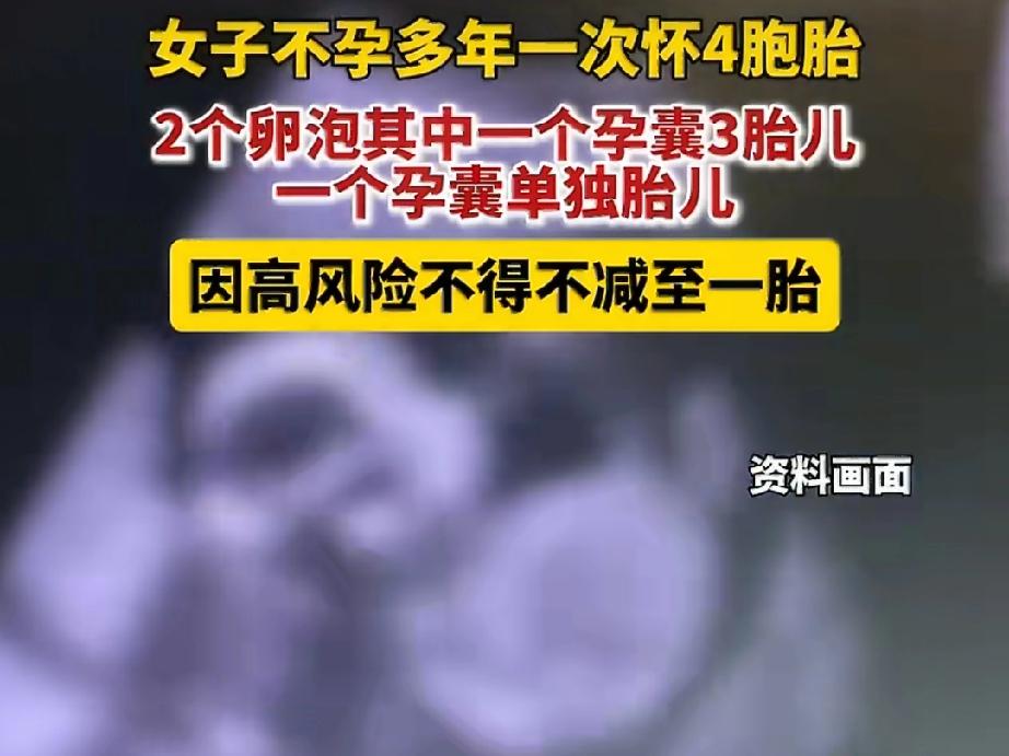 女子不孕多年怀了4胞胎，却含泪减3胎！广州的程女士（化名），为了要个孩子，熬