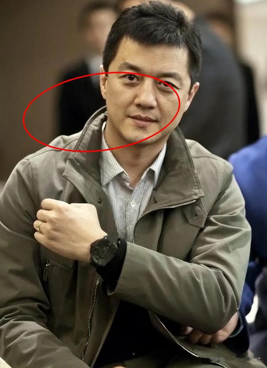 李亚鹏做生意亏成这样，嫣然基金却从没缺过钱。我亲眼见过嫣然在西藏的义诊。医院里