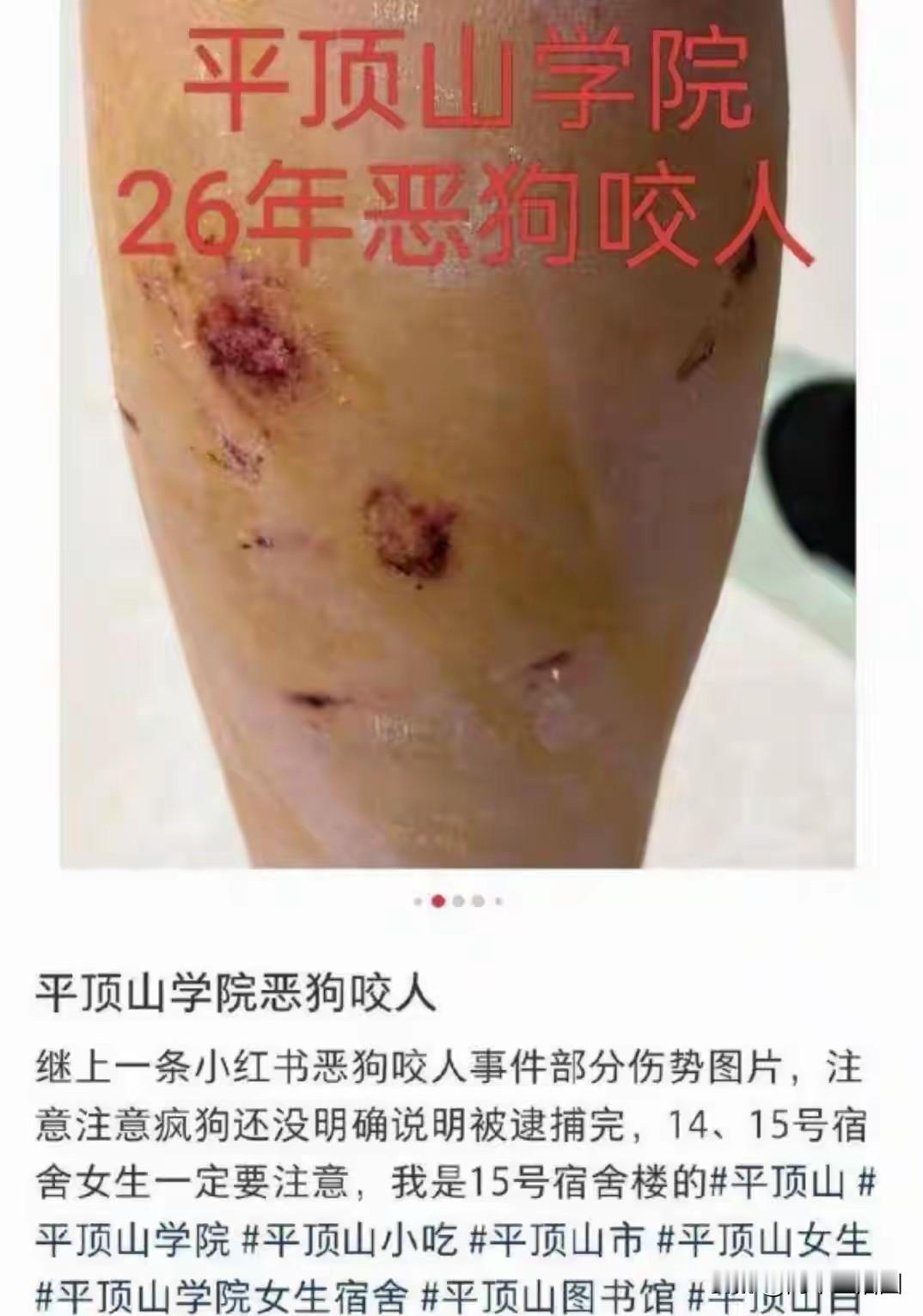 平顶山学院一名女学生夜里校内走路被群狗咬伤，竟有人骂她自作自受。河南平顶山学