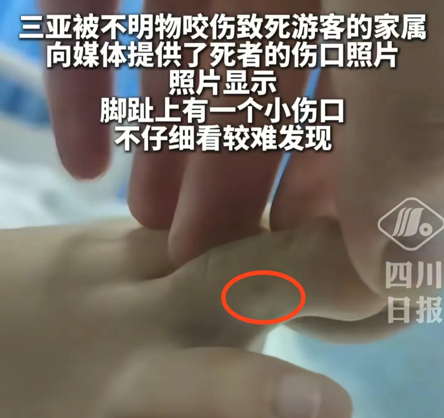 三亚遇难女子的死亡诊断结果已经出来，与医生诊断失误和药物使用不当有关系。遇难
