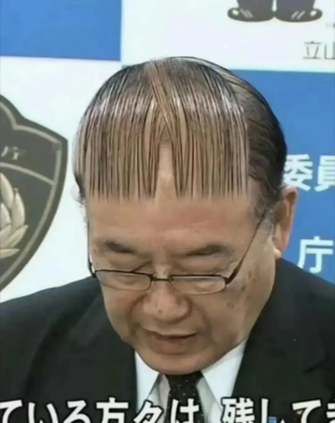 这刘海覆盖面之长，堪称一绝。有人调侃：“头发多了要造型，头发少了就以基本任务为主