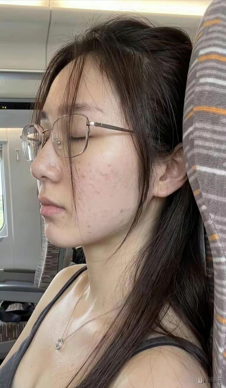 这女生脸上有痘印，一看就是青春期脸上很多痘痘的人，要是你和他相亲，你会愿意不？