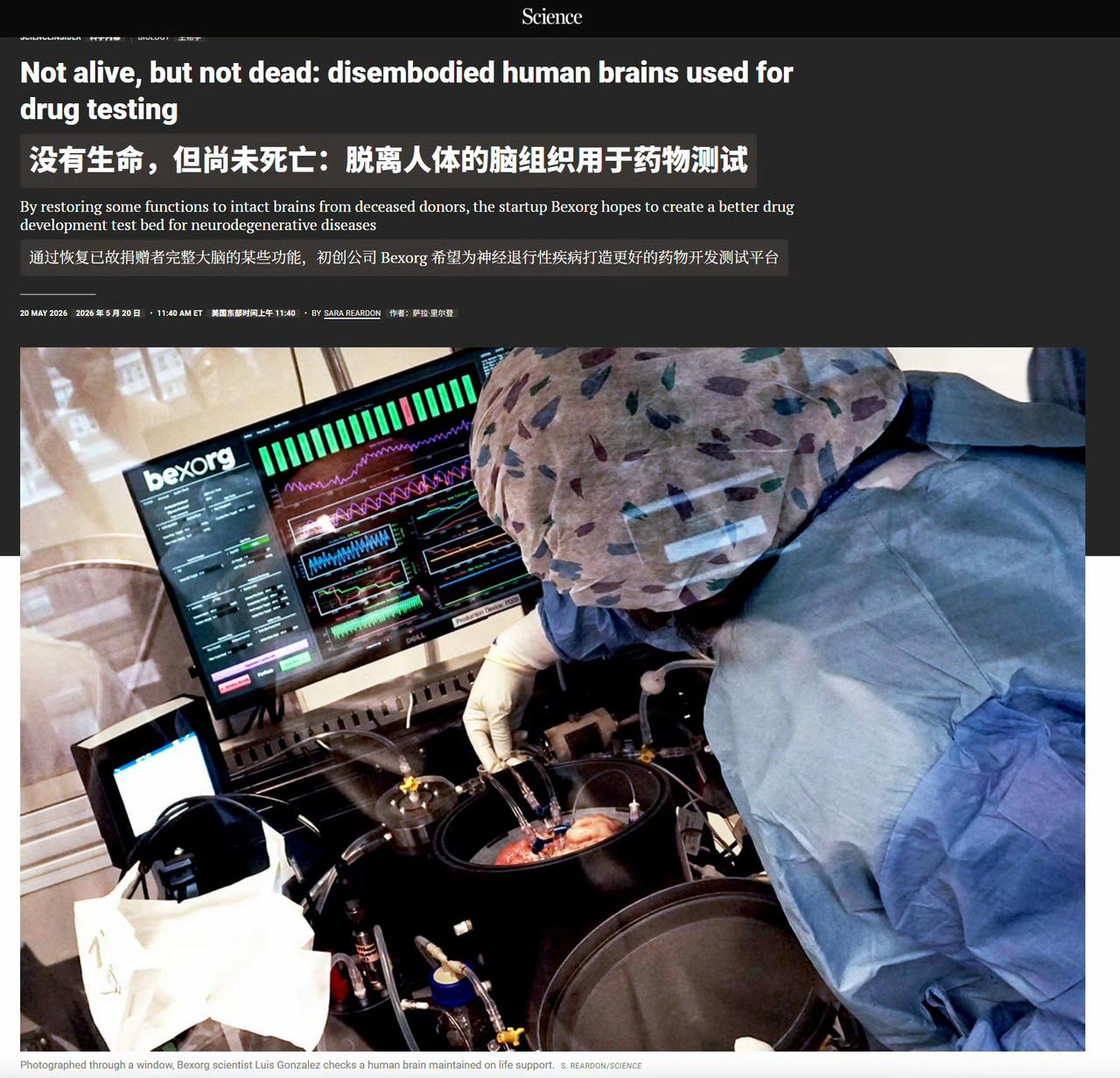 让人震惊！一个美国医药公司，掏了700多个人的脑子，体外循环维持活性，然后试验药