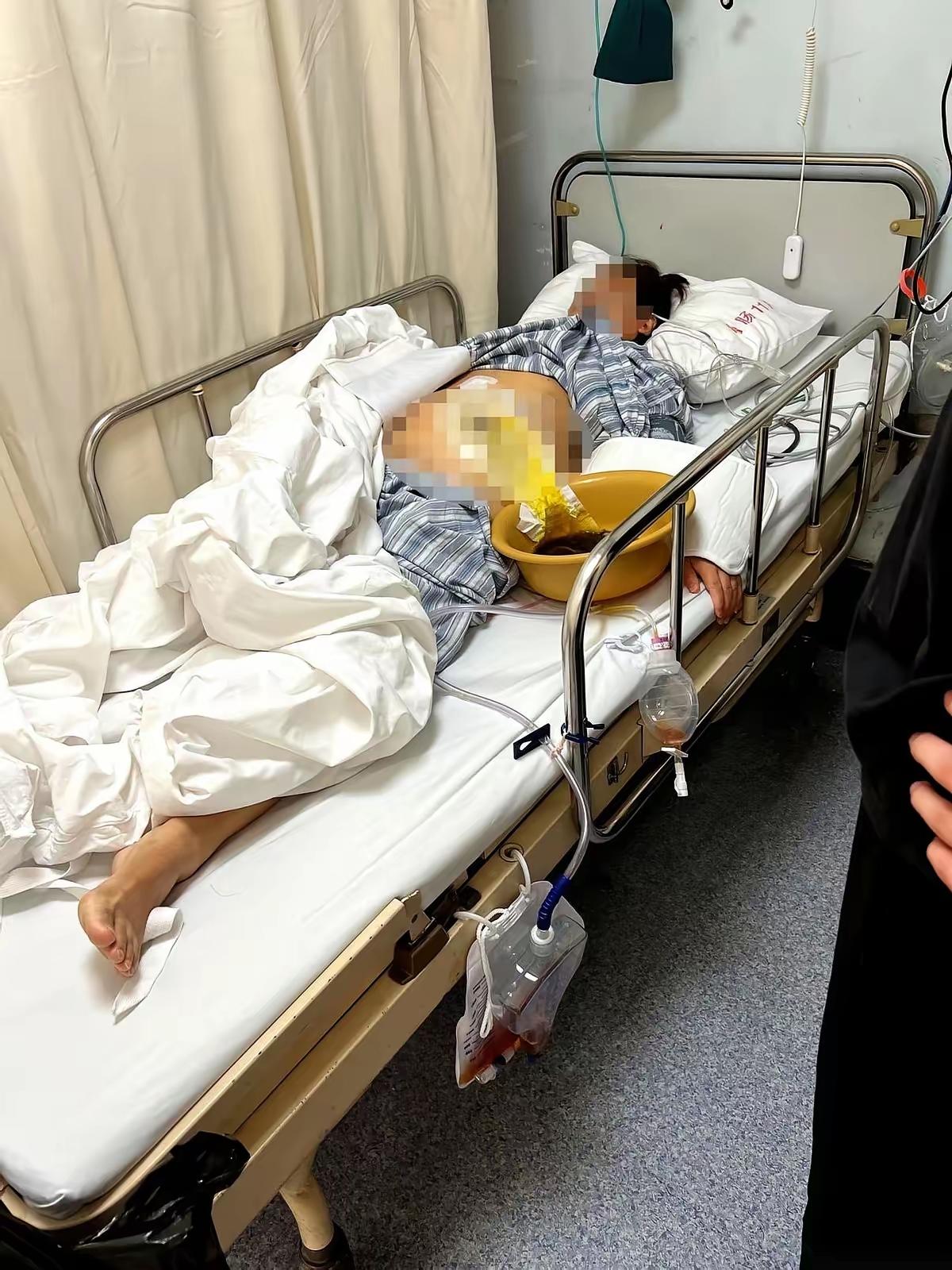 胃不舒服做胃肠镜，55岁阿姨走着进医院，竟熬出两次手术半年挂袋！这事儿想想都让人