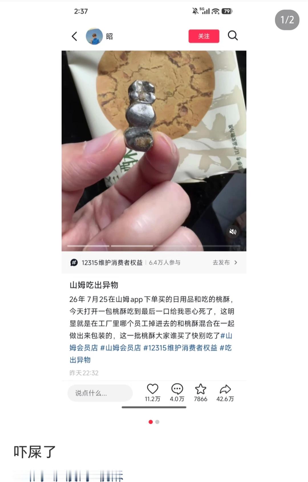 泸溪河桃酥牙冠泸溪河.....我嘞个豆！？吃个泸溪河集齐可怕事件这牙齿...