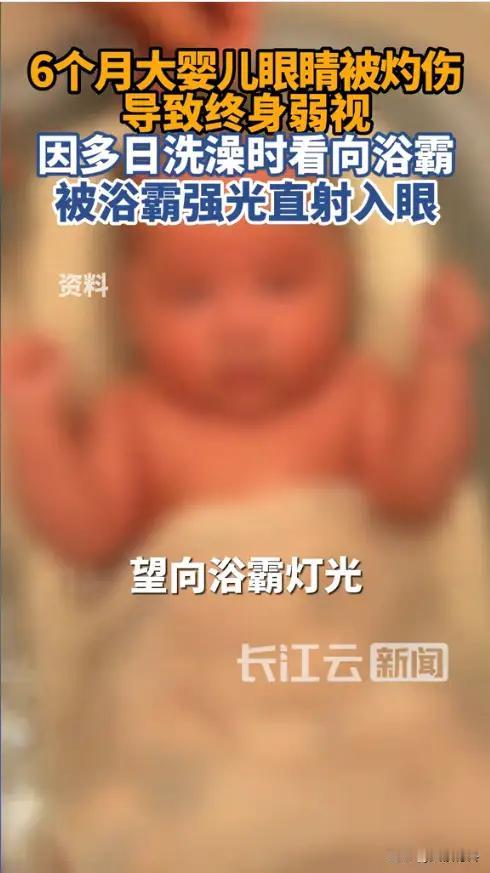 震惊！婴儿浴霸照成“视力杀手”！父母必看，别让悲剧重演！（来源:长江新闻）