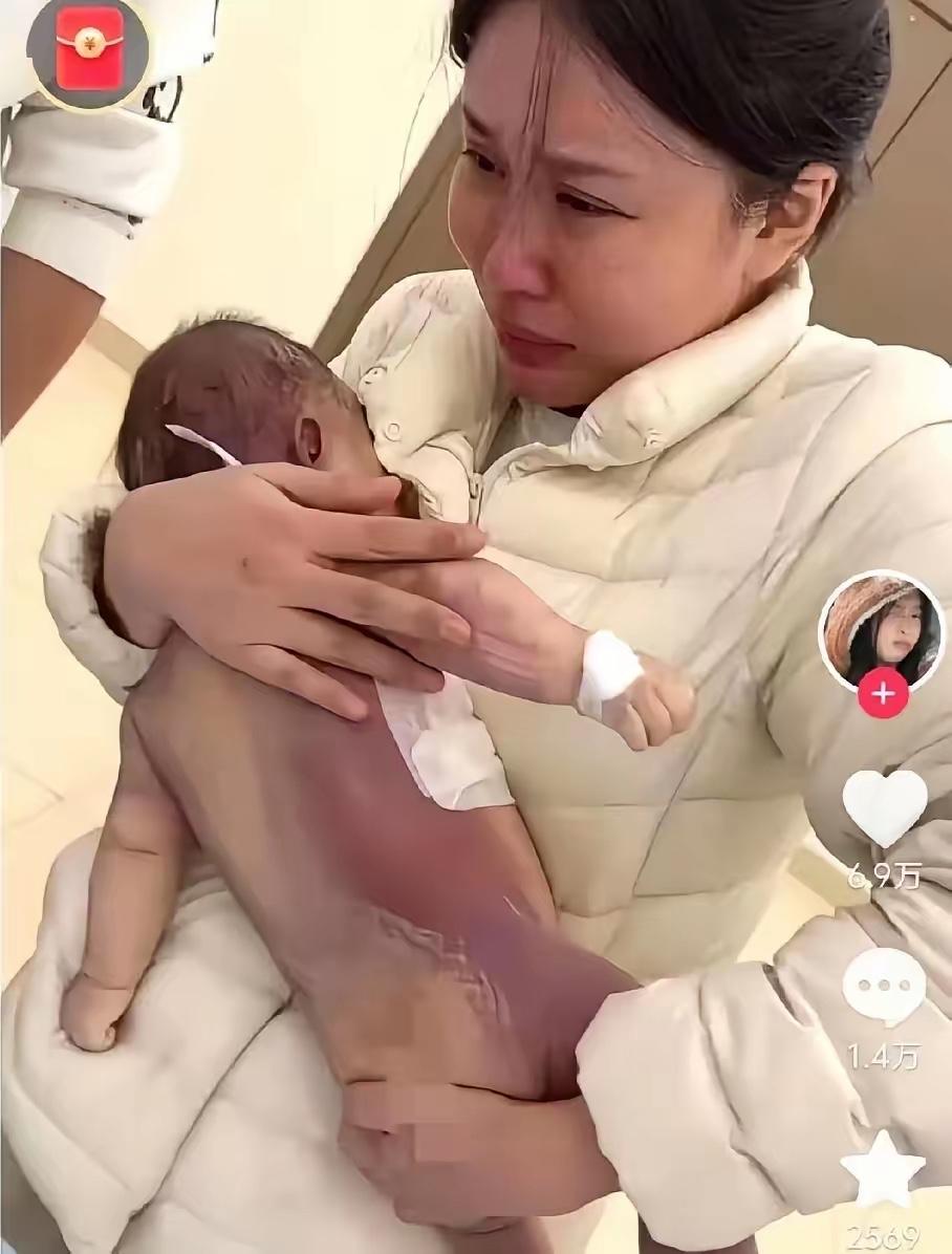 5个月洛熙宝宝手术去世的事，给所有的父母都敲了个警钟，那就是当宝宝或者伴