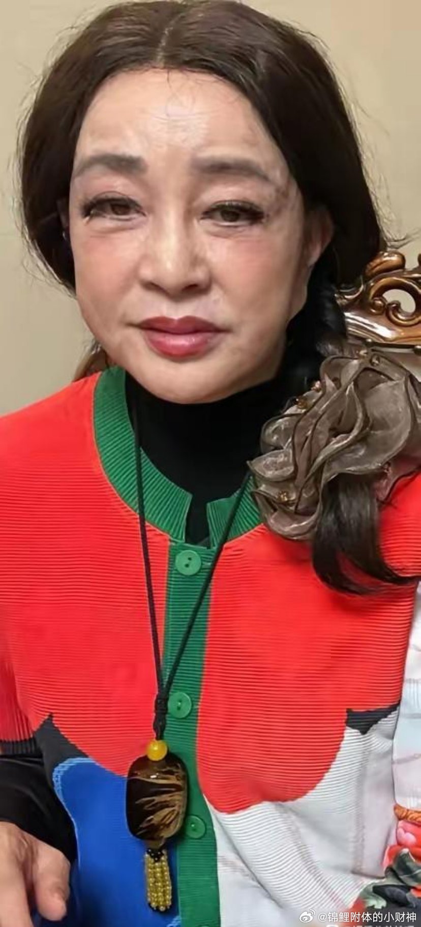 刘晓庆真实近照真吓人刘晓庆这1700万，算是白砸了。76岁近照，苹果肌绷得像打了