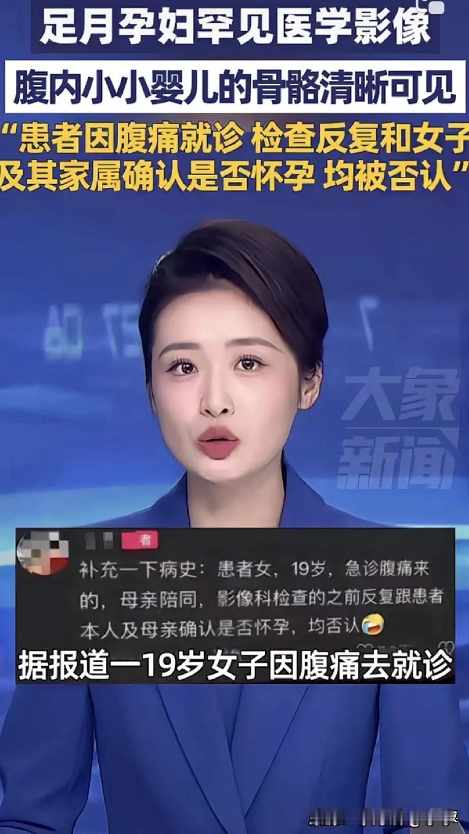 山西19岁少女，腹痛难以忍耐，家人带去医院看病在医院的时候要被拍片，医生看